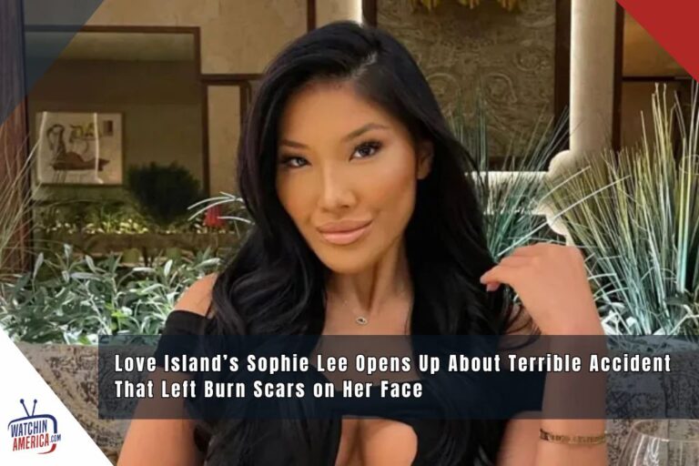 Love Island’s Sophie Lee Opens Up About Terrible Accident That Left Burn Scars on Her Face love-island-fans-tear-up